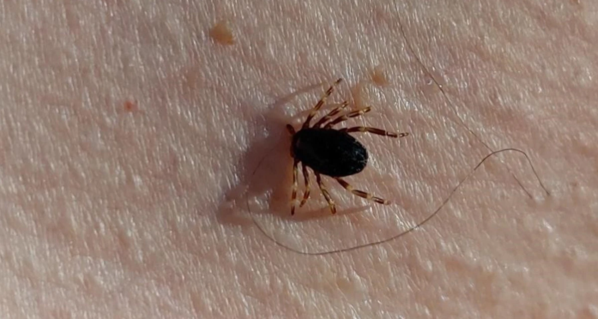 Çorum da Kene Isırığı Nedeniyle Hastaneye Kaldırılan Çiftçi öldü