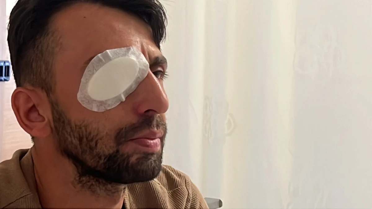 Konya’da Balkondan Ateş Açıldı: İşçi Sağ Gözünden Yaralandı